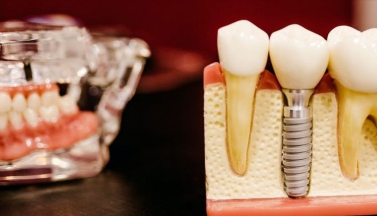 DESS Dental lanza su nueva web, unificando idiomas i países